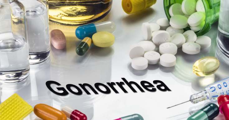 What Is Gonorrhea Causes Treatments Symptoms And More